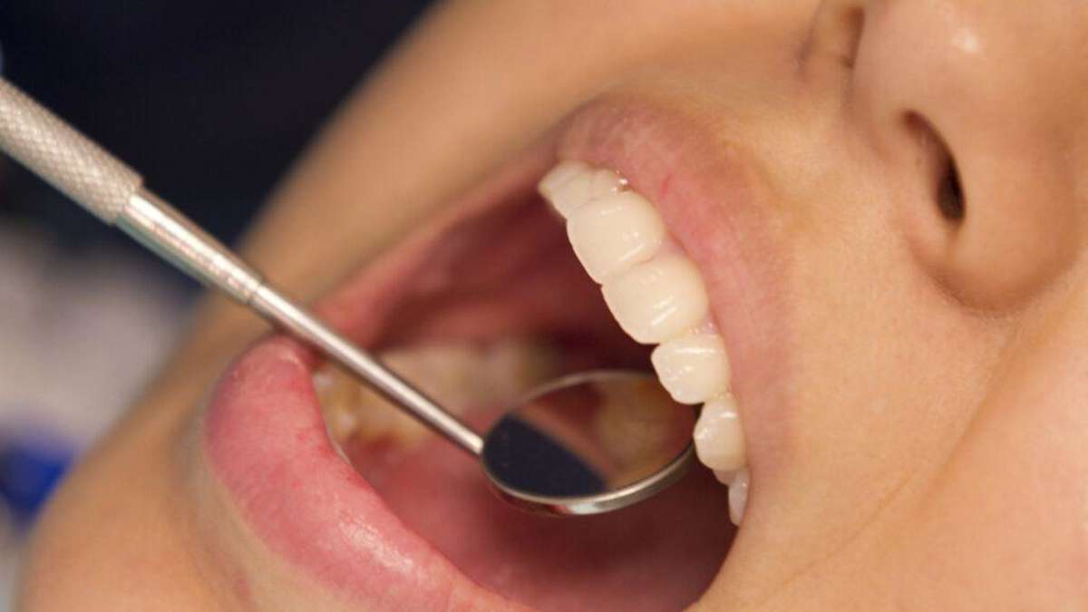 Gum Disease Linked to Heart Valve Damage: New Research Insights Revealed