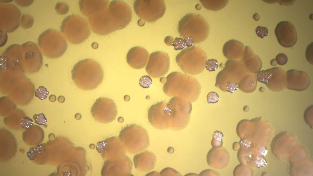 Harmless Bacteria Turn Dangerous: Unraveling the Mystery of Antibiotic Resistance
