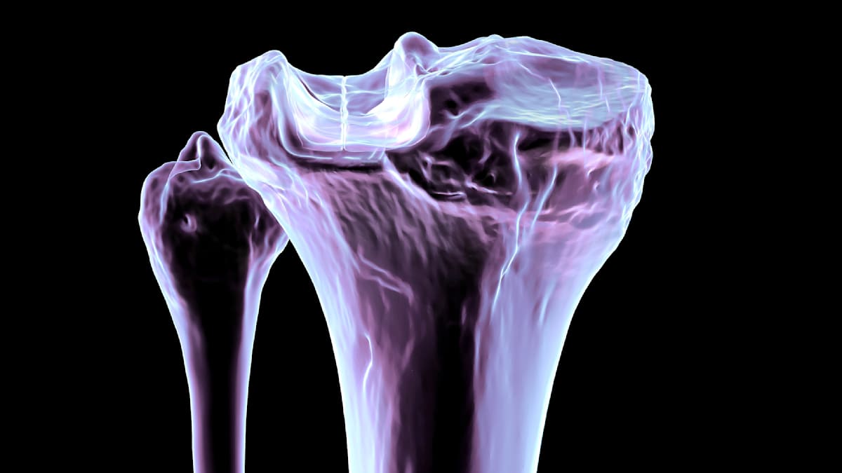How Vitamin D Secrets Help Bones Heal Faster: New Research Uncovered