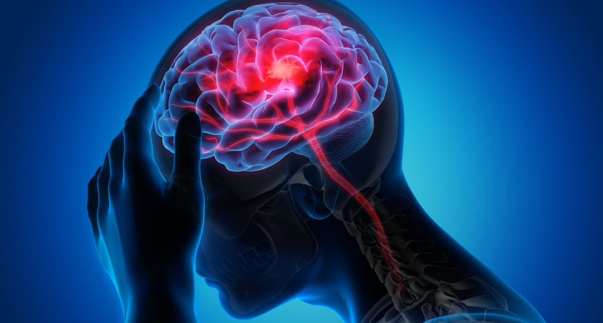 Ischemic Stroke Treatment: Thrombolysis Potential Up to 24 Hours