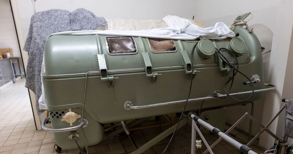 Last Iron Lung User Dies: Legacy of Polio’s Battle Fades Away