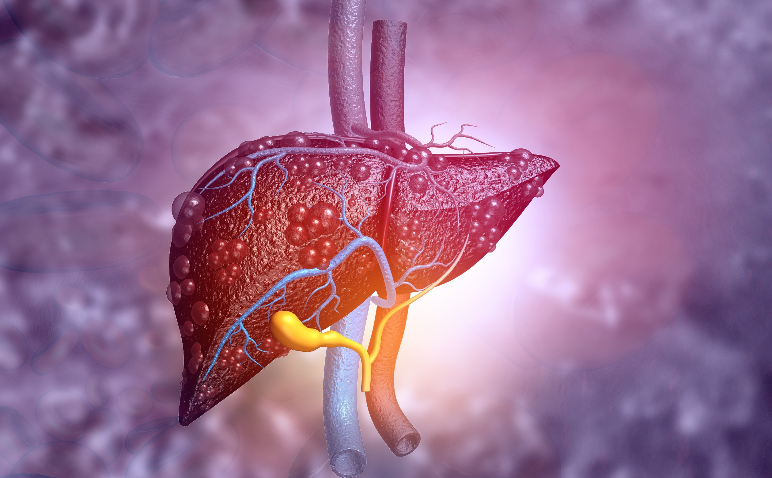 Non-Alcoholic Fatty Liver Disease: Fourfold Risk of Heart Disease