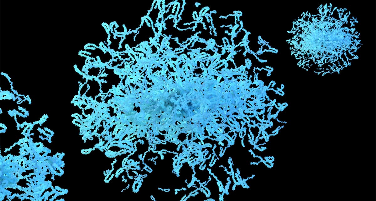 Parkinson Drug Shows Signs of Slower Disease Progression Despite Study Setbacks