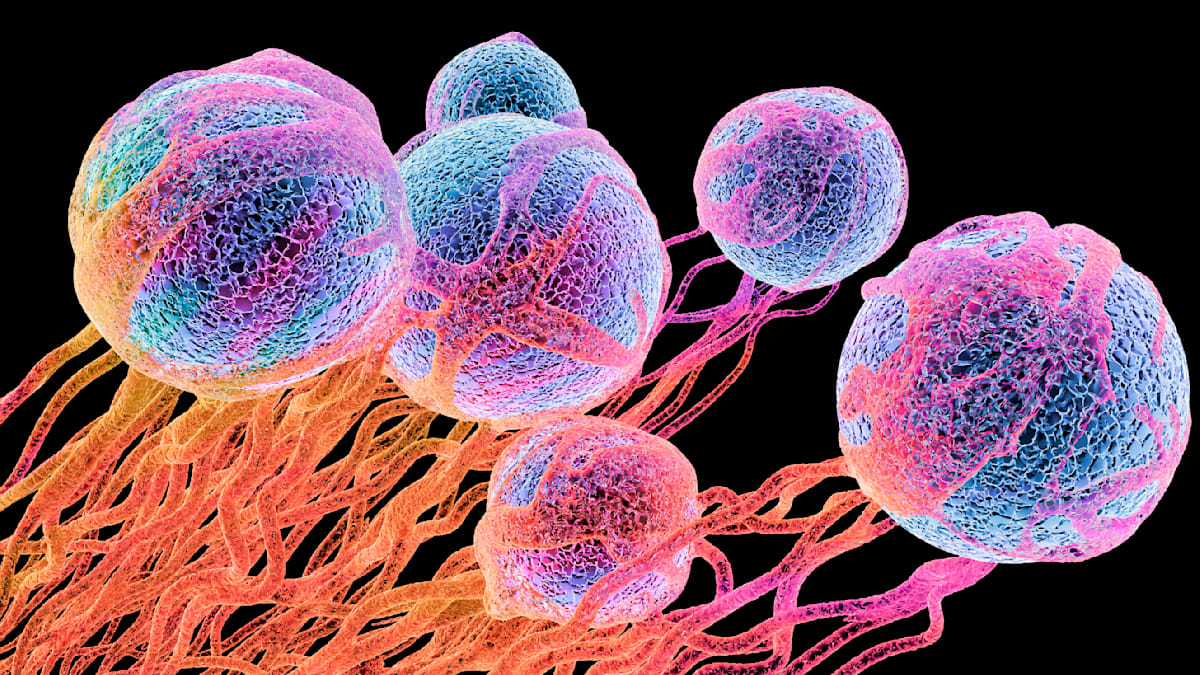 Prostate Cancer Breakthrough: Promising Long-Term Therapy Results Unveiled