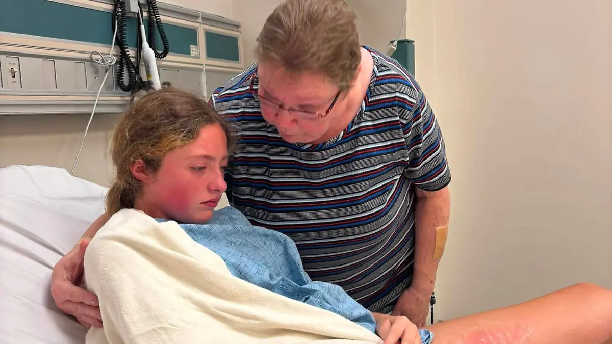Squishy Toy Explodes in Hot Car: Teen Suffers Severe Burns