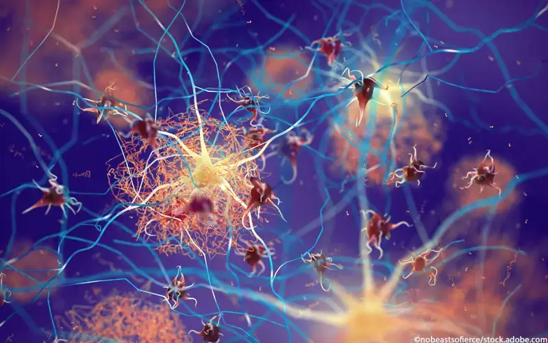 Women with Parkinson’s at Higher Risk of Alzheimer’s Pathology: New Insights